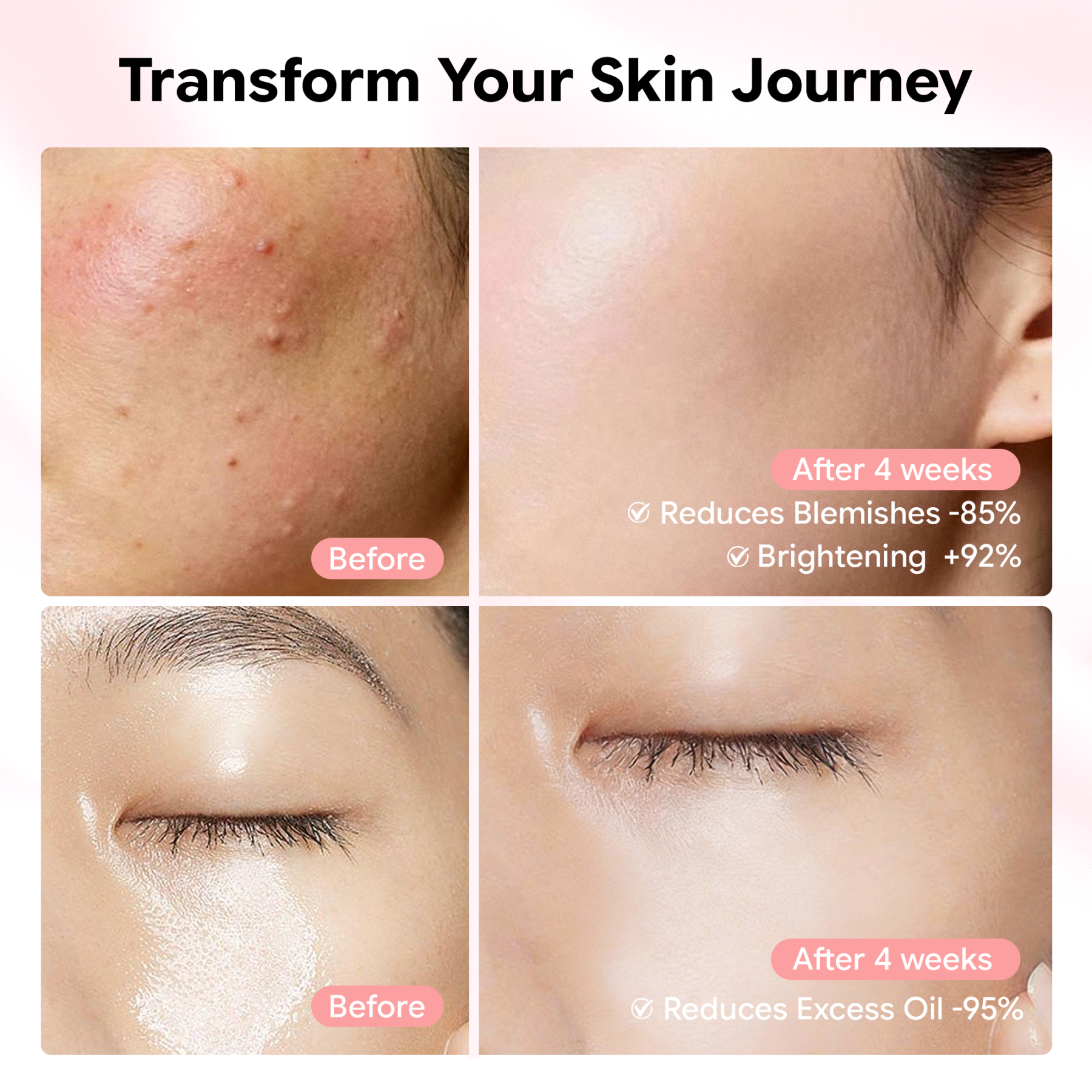 Jtopyrt Niacinamide 10 + TXA 4 Serum Hyperpigmentation, Uneven Skin Tone Corrector for Dull Skin & Fine Lines