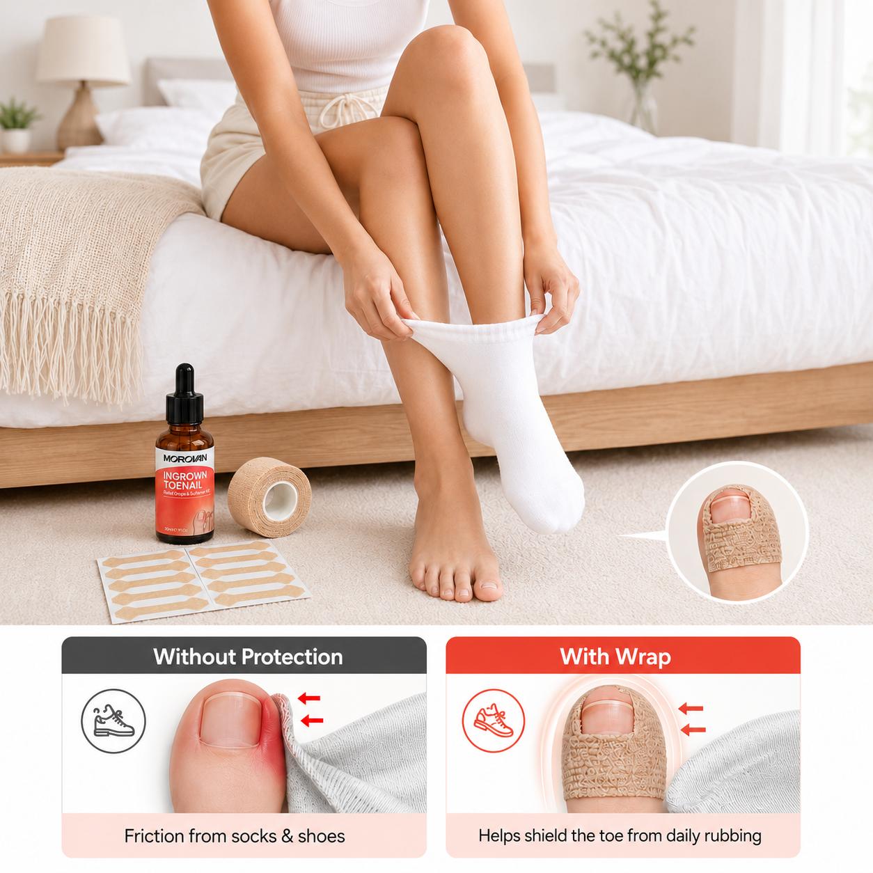 Morovan Ingrown Toenail Treatment,30ml Gentle Solution Kit for Men & Women, Toenail Care