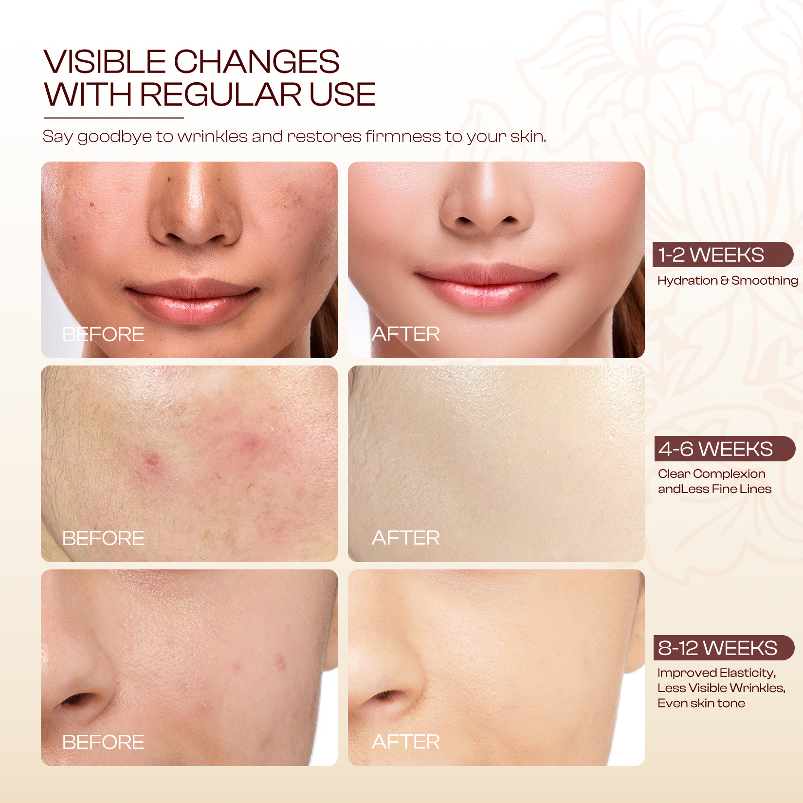 Hibiscus & Honey Firming Cream for Neck & Face – Collagen-Infused Anti-Aging Moisturizer with Retinol & Hyaluronic Acid – Skin Tightening Lotion to Reduce Lines & Crepey Skin – 1.7 oz