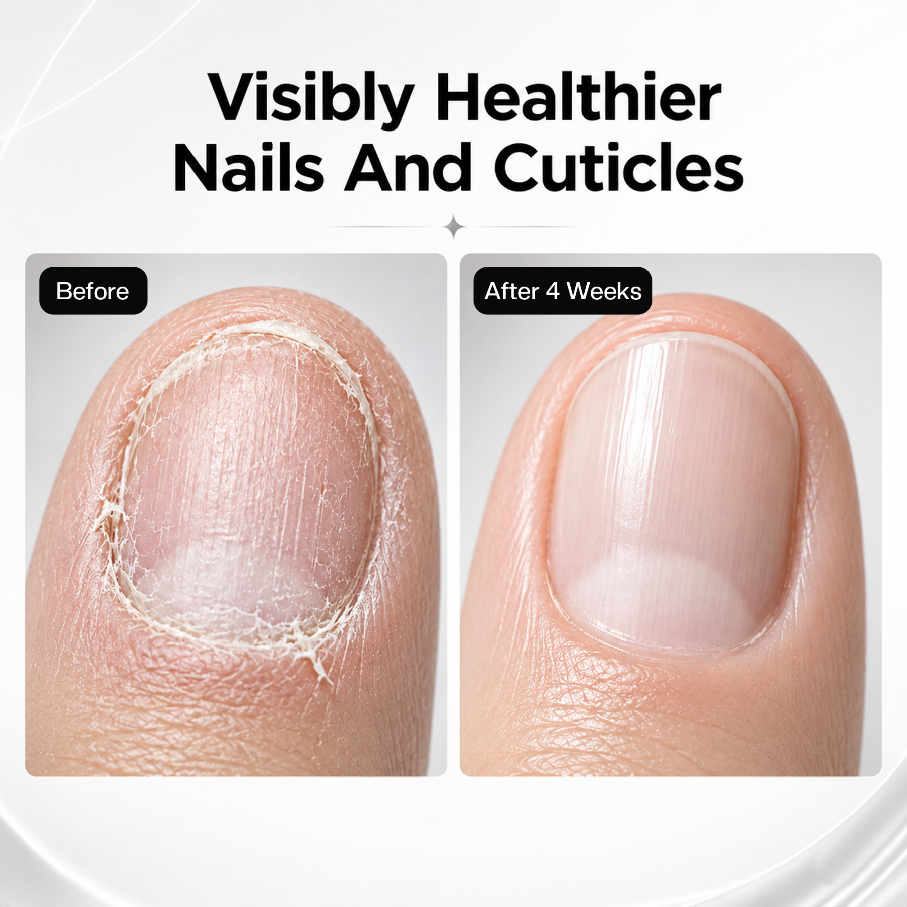 Morovan Nail Repair Gel Cream, Strengthens Nails & Conditions Cuticles, Fast-Absorbing Non-Greasy Formula, 1 fl.oz													