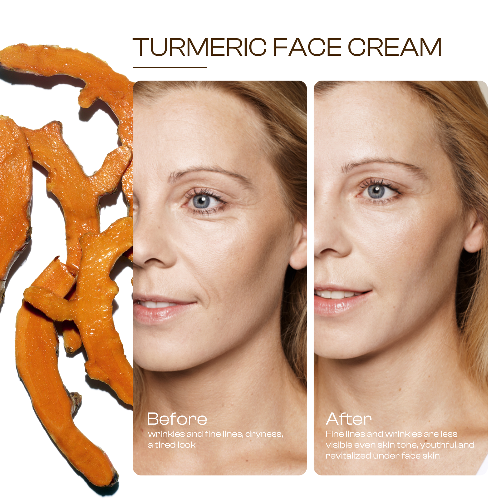 Turmeric Face Cream with Vitamin C –Fades Dark Spots & Hydrates Dry/Oily Skin