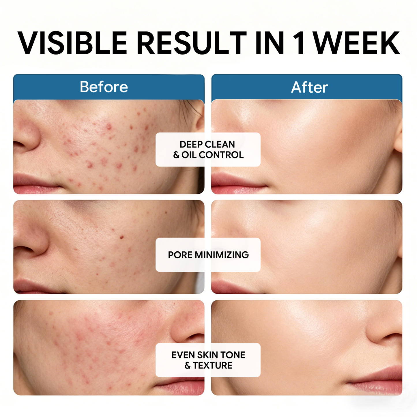 Glycolic Acid Toner Solution Exfoliating Face Toner for Dark Spots Uneven Skin 8.45 fl oz