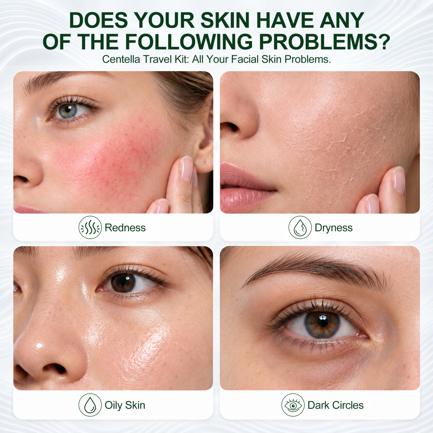 Jtopyrt Centella Cica 5-Piece Anti-Redness Soothing Skincare Set Gentle Daily Routine for Sensitive and Redness-Prone Skin