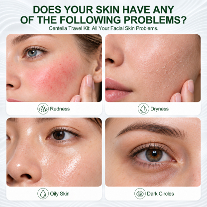 Jtopyrt Centella Cica 5-Piece Anti-Redness Soothing Skincare Set Gentle Daily Routine for Sensitive and Redness-Prone Skin