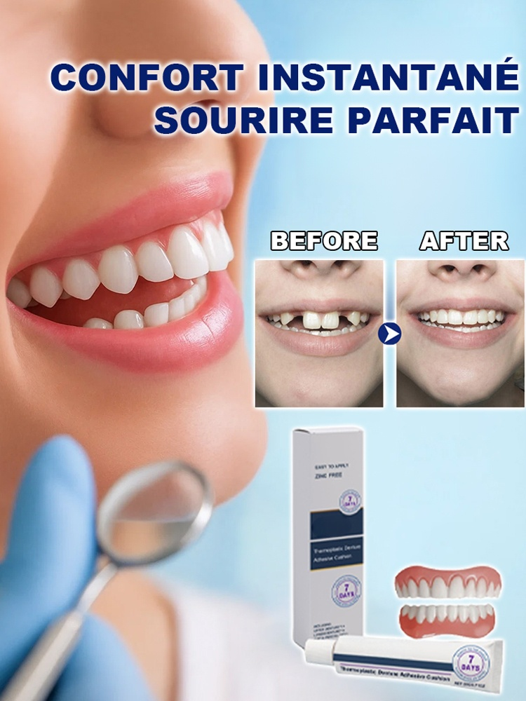 Pas de dentiste, Pas de moulage. Ensemble de prothèses dentaires beauté