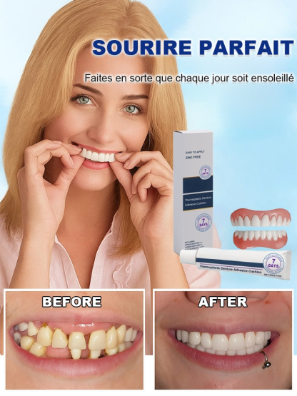 Pas de dentiste, Pas de moulage. Ensemble de prothèses dentaires beauté