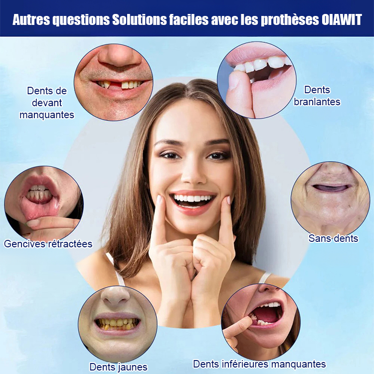 Mieux que de vraies dents! Kit de restauration esthétique des dents prothétiques