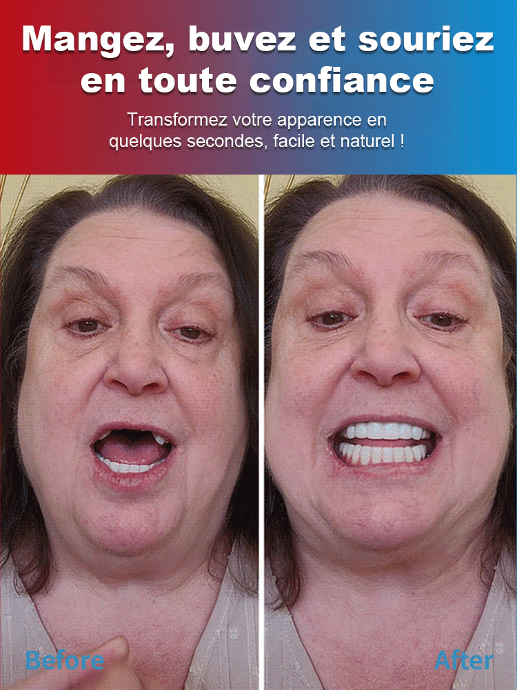 Pas de dentiste, Pas de moulage. Ensemble de prothèses dentaires beauté