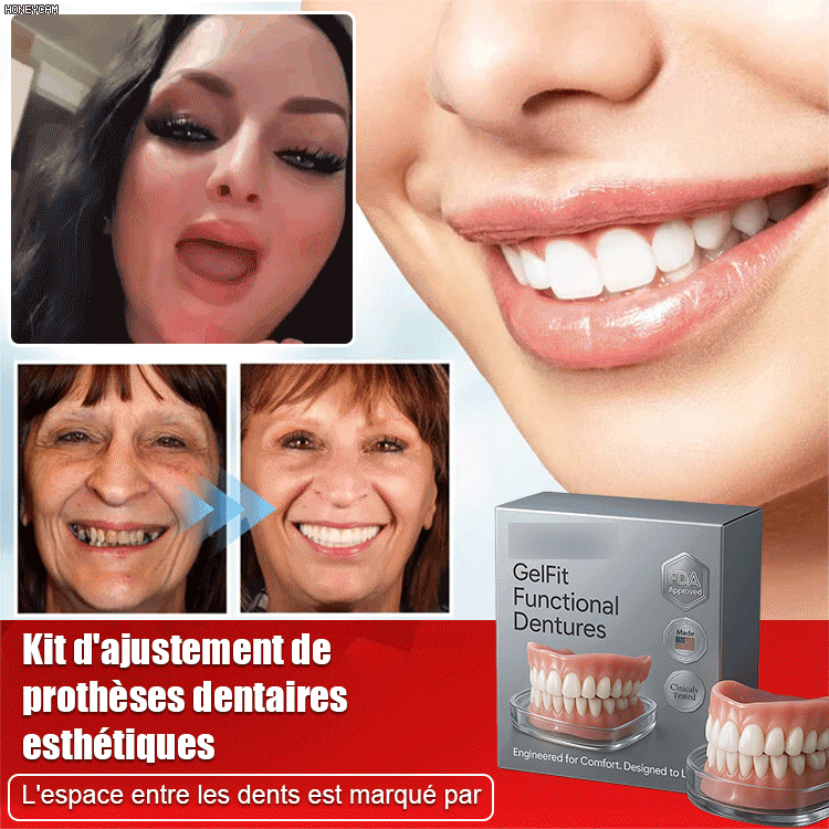 Mieux que de vraies dents! Kit de restauration esthétique des dents prothétiques