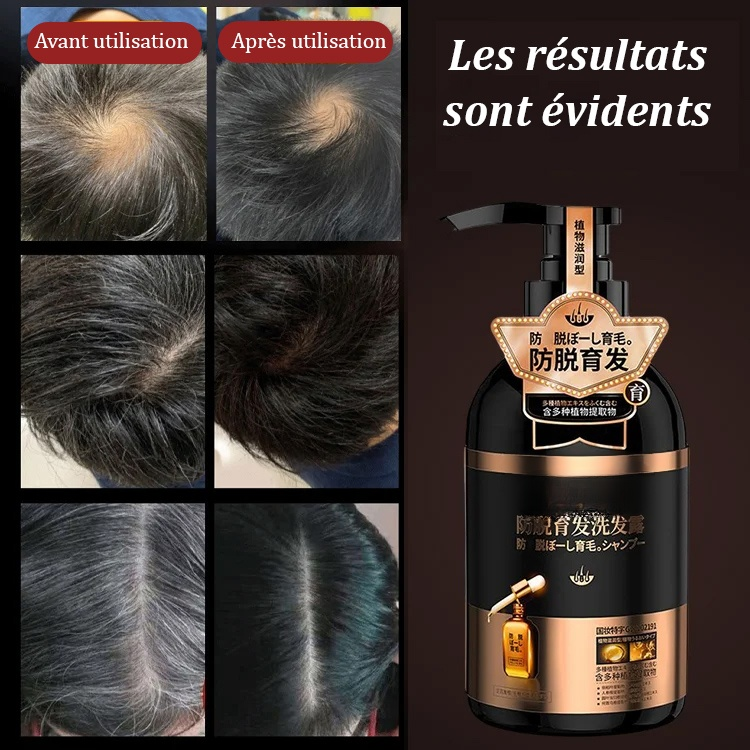 Shampoo anti-chute et noircissant des cheveux pour hackers blancs et noirs