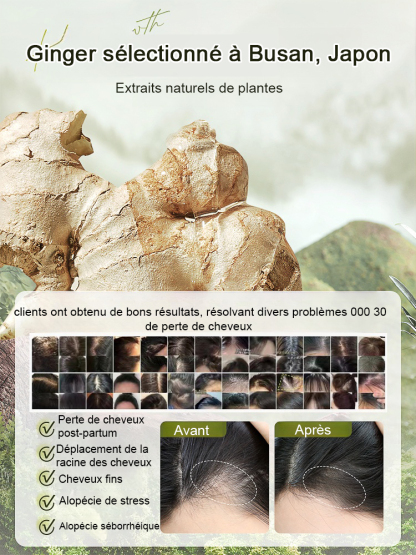 Hot Sale Ginger Plant Extract Anti-Hair Loss Hair Shampooing