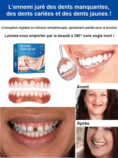 Dernière recherche et développement du département dentaire, les appareils dentaires en silicone à adsorption