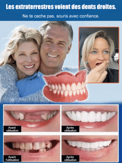 🦷Développé conjointement par 100 dentistes, dites adieu aux prix exorbitants! Kit de réparation de prothèses dentaires