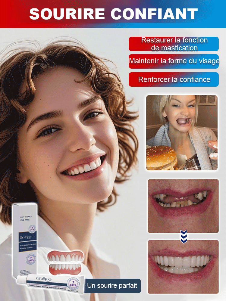 Pas de dentiste, Pas de moulage. Ensemble de prothèses dentaires beauté