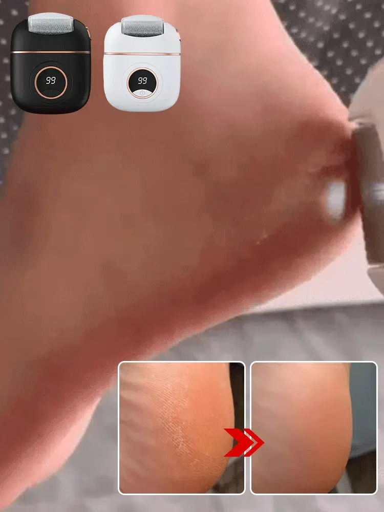 【Másodpercenként elhalt bőr eltávolítása】Új digitális kijelzős elektromos sarokcsiszoló