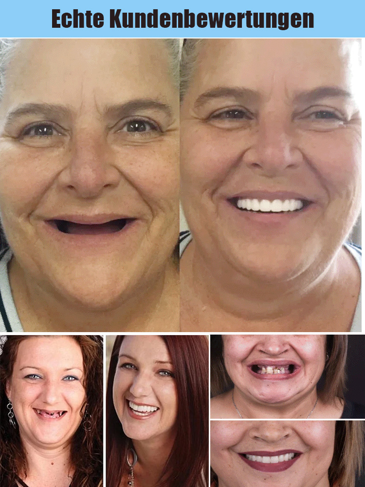 [Hergestellt in den USA, FDA-zugelassen] Prothesenanpassungsset