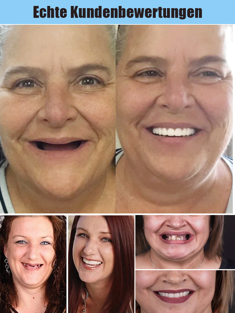 [Hergestellt in den USA, FDA-zugelassen] Prothesenanpassungsset