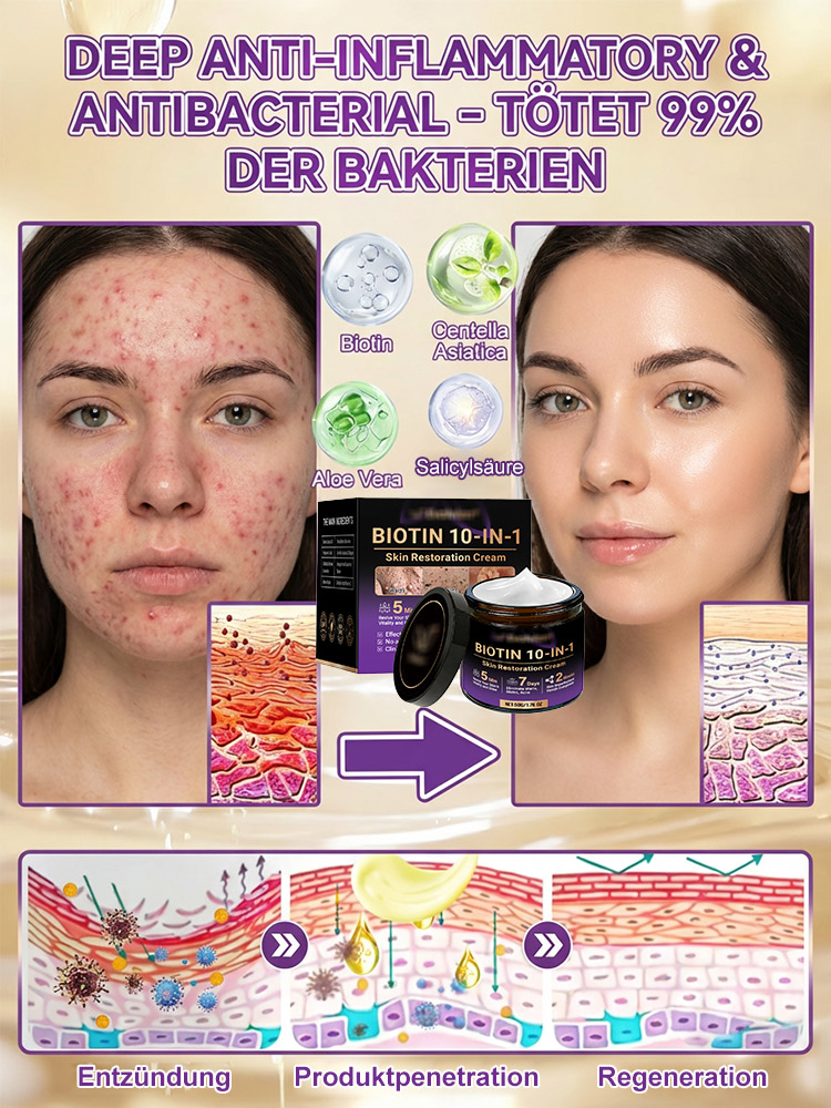 【In 2 Wochen alle Hautprobleme verabschieden】Biotin Hautreparaturcreme