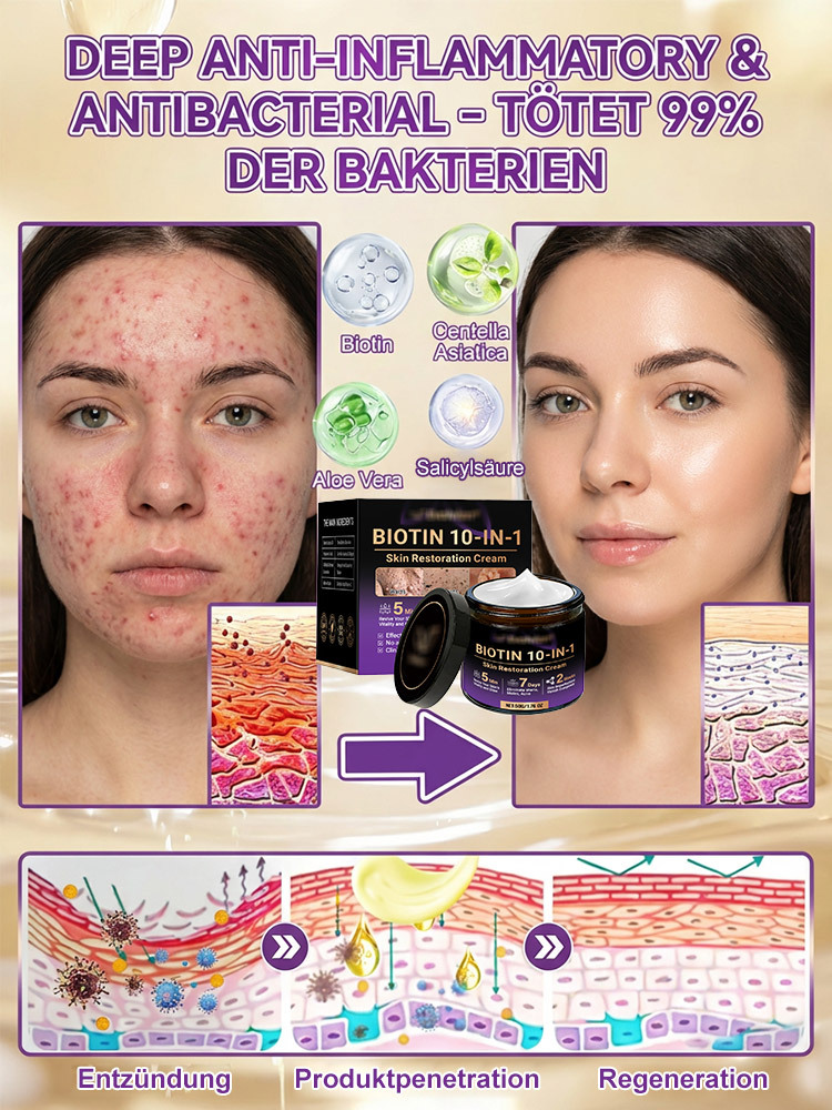 【In 2 Wochen alle Hautprobleme verabschieden】Biotin Hautreparaturcreme