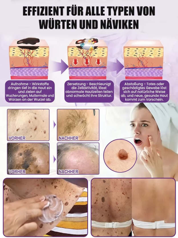 【In 2 Wochen alle Hautprobleme verabschieden】Biotin Hautreparaturcreme