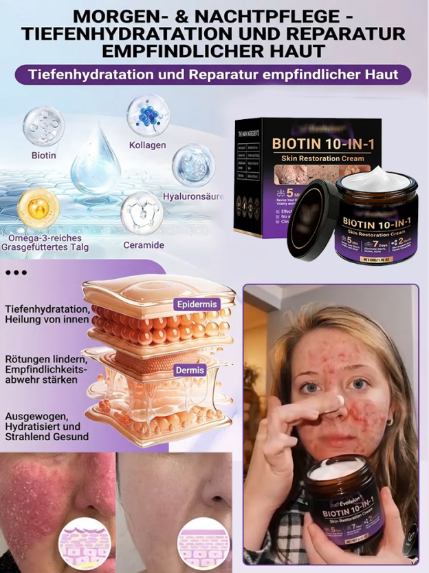 【In 2 Wochen alle Hautprobleme verabschieden】Biotin Hautreparaturcreme