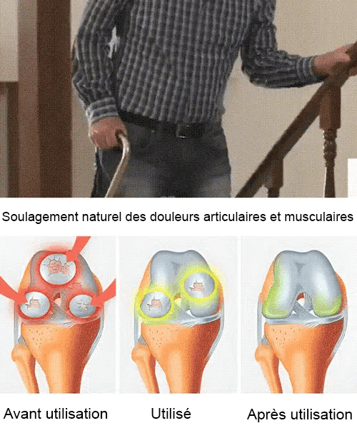 Cherry Tree Seedling [200KG Cherries in 30 Days] 