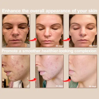 LED Mask Light Therapy PRO