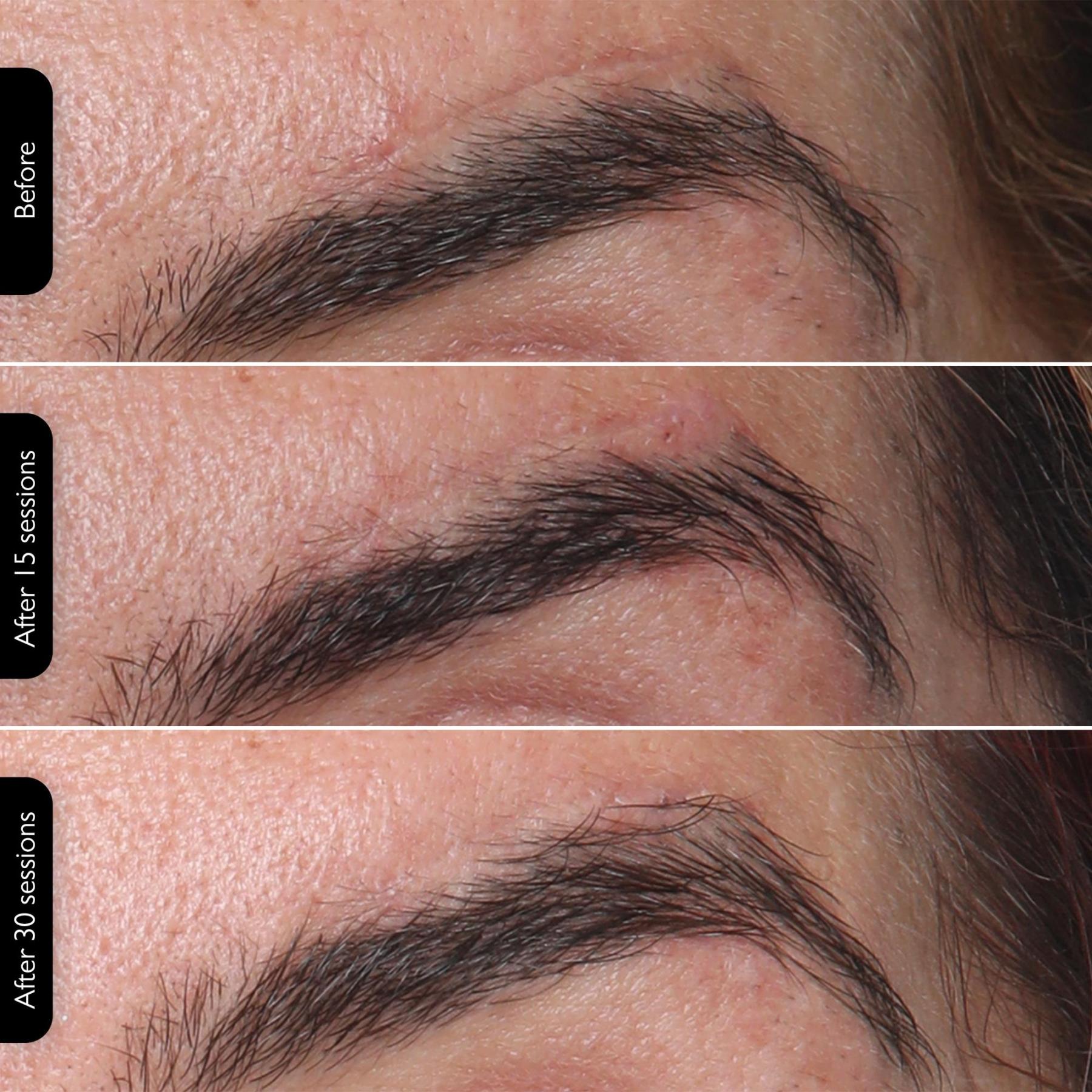 ** LED Face Mask – 4-in-1 Multi-Functional Skin Care Device**  