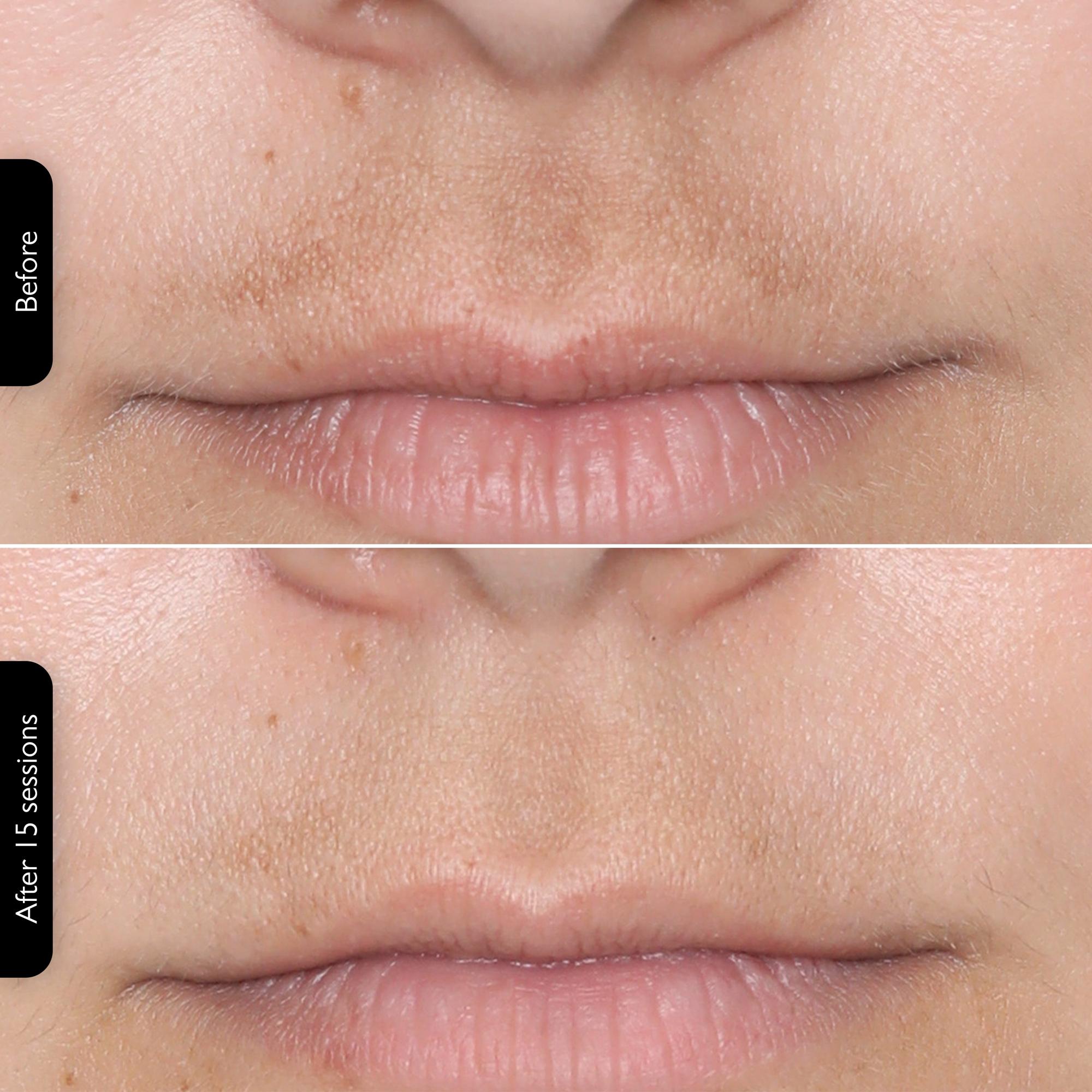 ** LED Face Mask – 4-in-1 Multi-Functional Skin Care Device**  