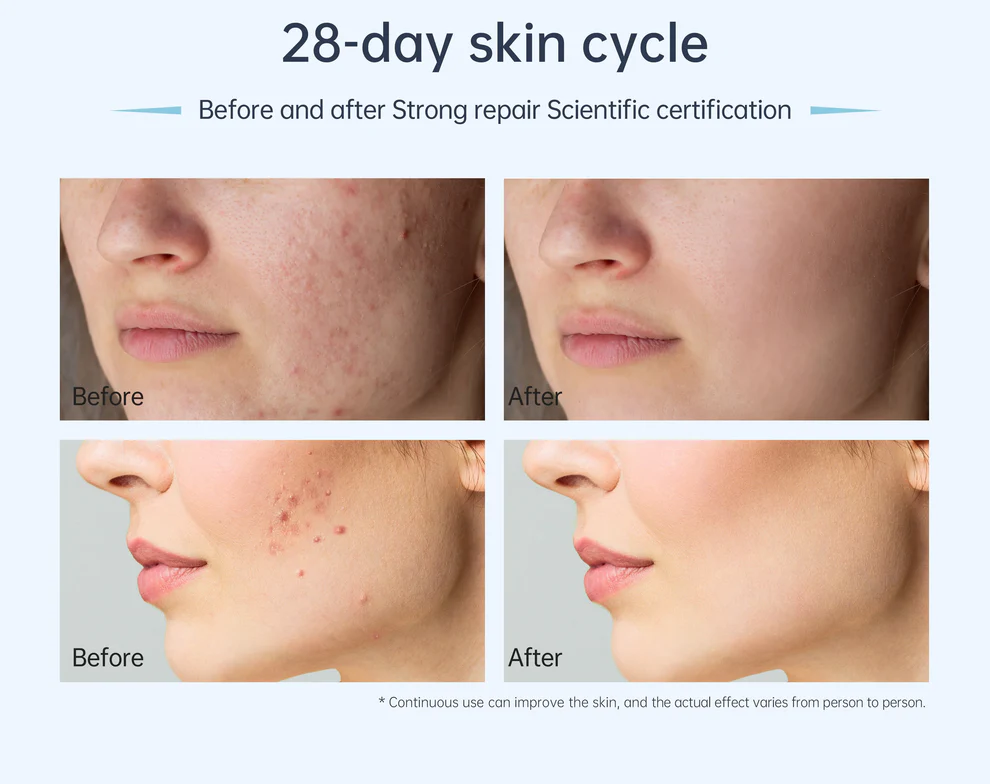 Dr. Pen A11 Ultima PRO Microneedling Pen