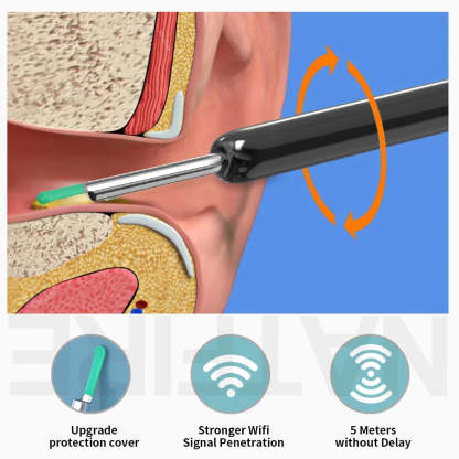 Smart Visual Ear Cleaner