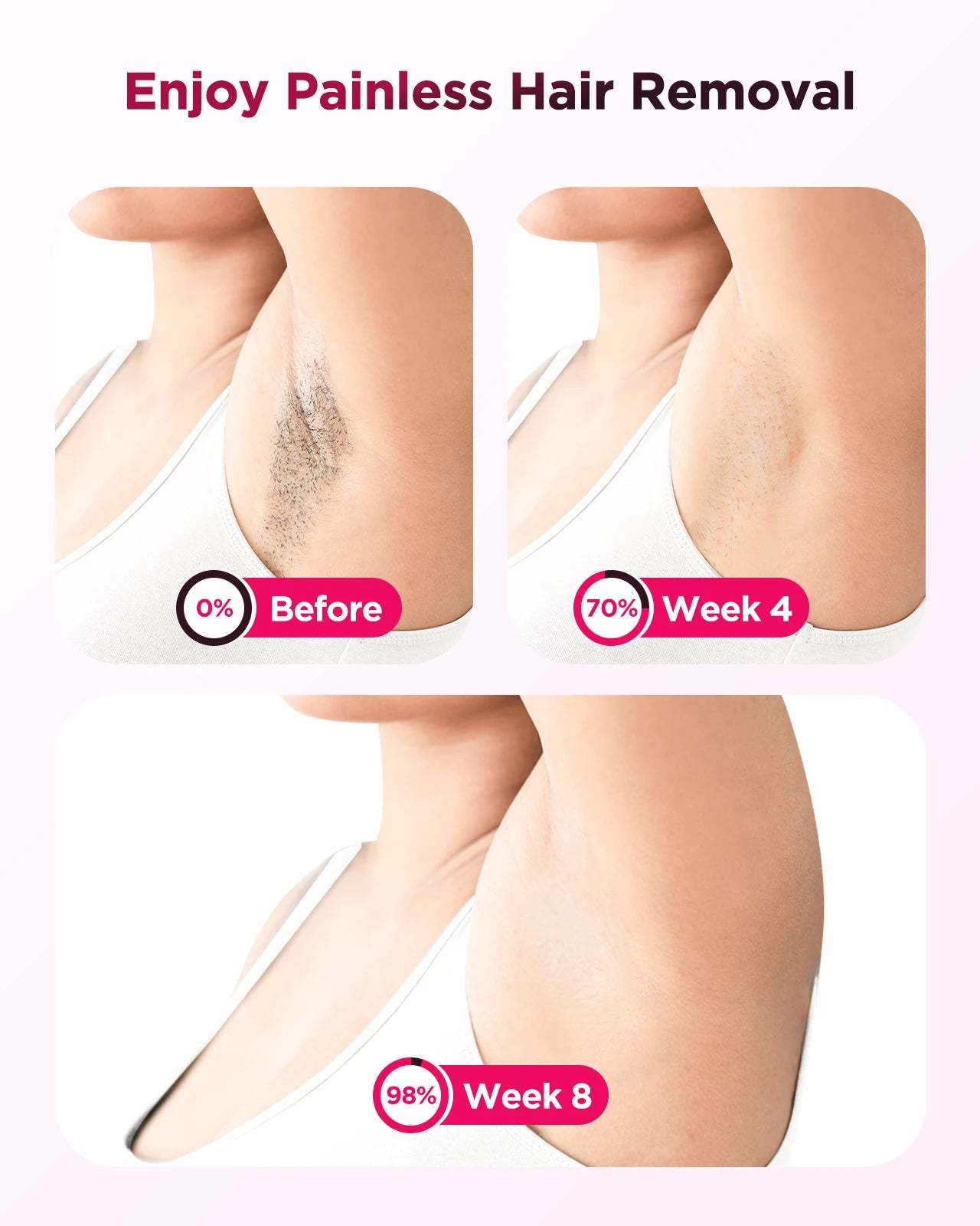 Flash Laser Epilator IPL Hair Removal Machine
