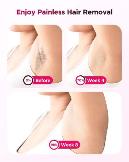 Flash Laser Epilator IPL Hair Removal Machine