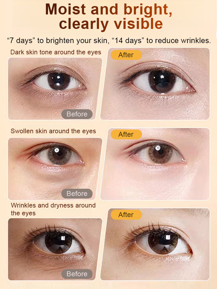 Developed by the laboratory of Tokyo University in Japan for 20 years, it can reduce fine lines in three days and eliminate all kinds of wrinkles in seven days. It is free to use for 14 days. If you are not satisfied after use, you will get a full refund.