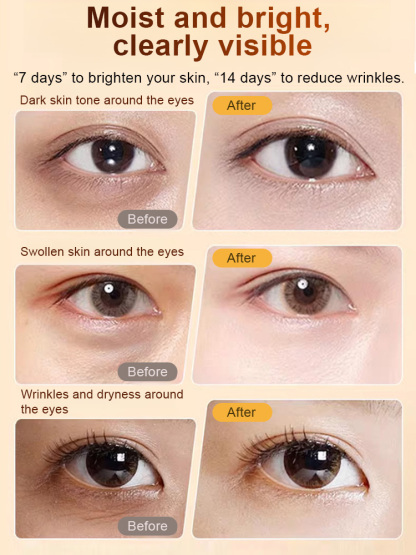 Developed by the laboratory of Tokyo University in Japan for 20 years, it can reduce fine lines in three days and eliminate all kinds of wrinkles in seven days. It is free to use for 14 days. If you are not satisfied after use, you will get a full refund.