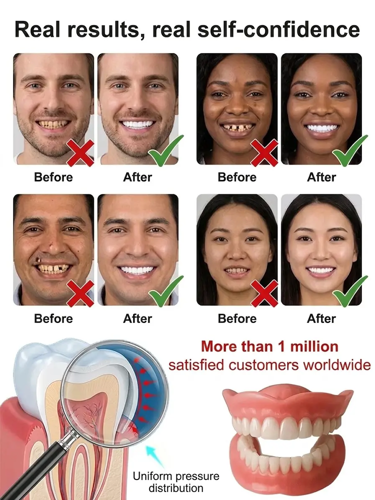 【Recreating the Hollywood Smile】Strongly Adhesive Medical Full Dentures