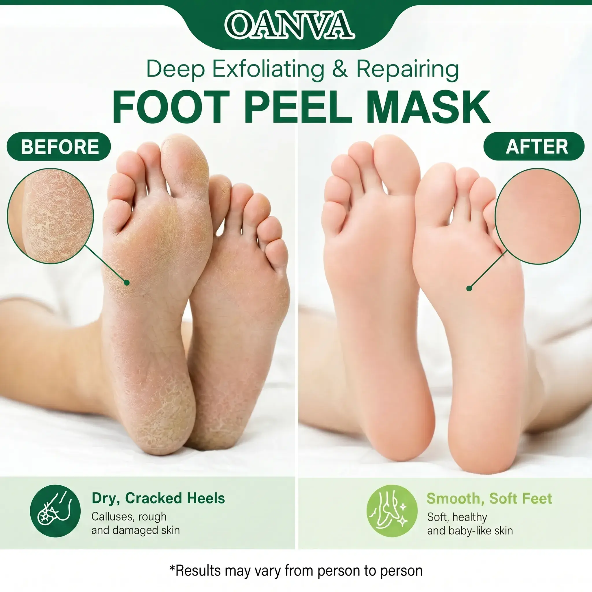 Foot Peeling Mask, Exfoliating Foot Peel Mask with Avocado Oil & Coconut Oil, Remove Dry Dead Skin & Calluses, Repair Cracked Heels for Baby Soft Feet