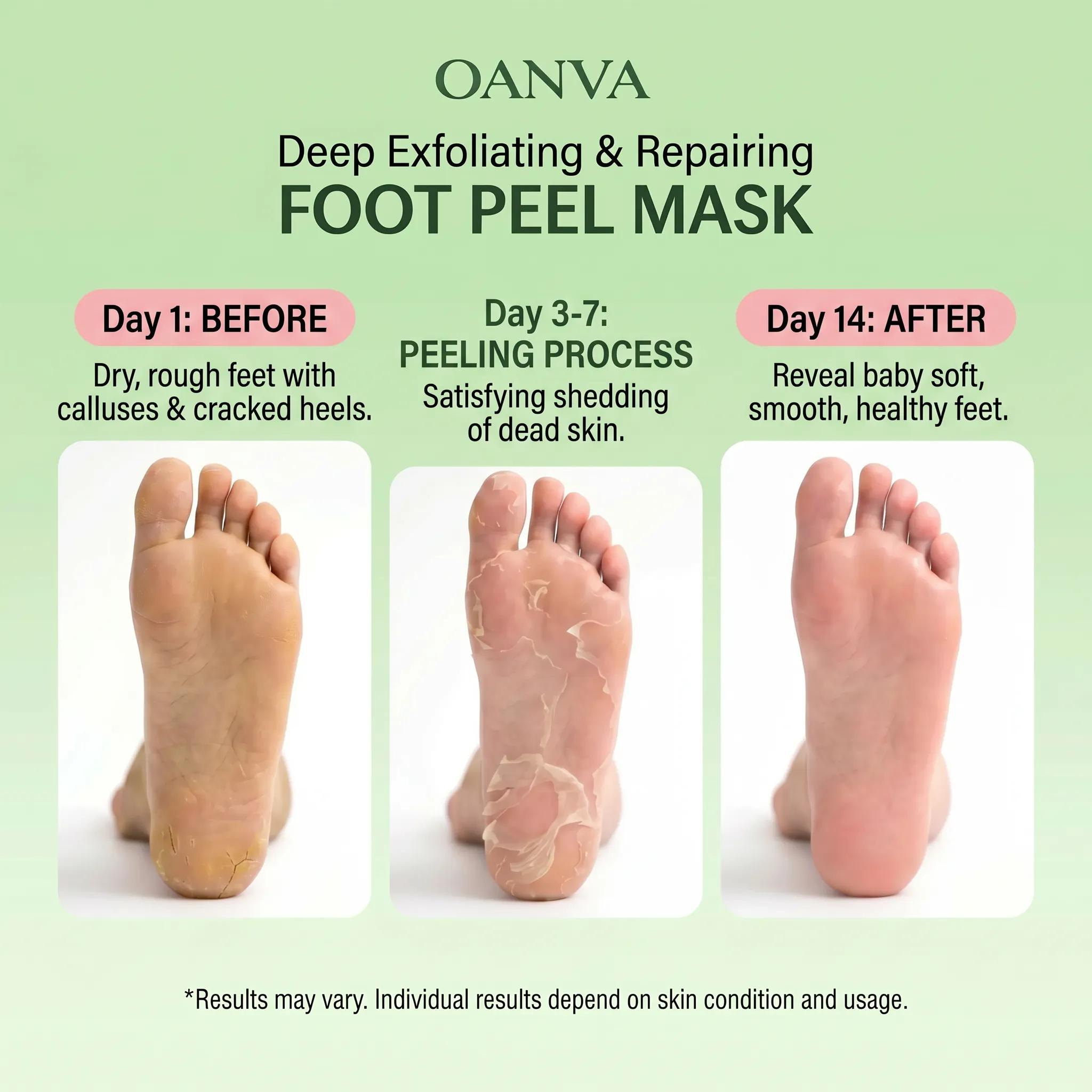 OANVA Foot Peeling Mask, Exfoliating Foot Peel Mask with Avocado Oil & Coconut Oil, Remove Dry Dead Skin & Calluses, Repair Cracked Heels for Baby Soft Feet