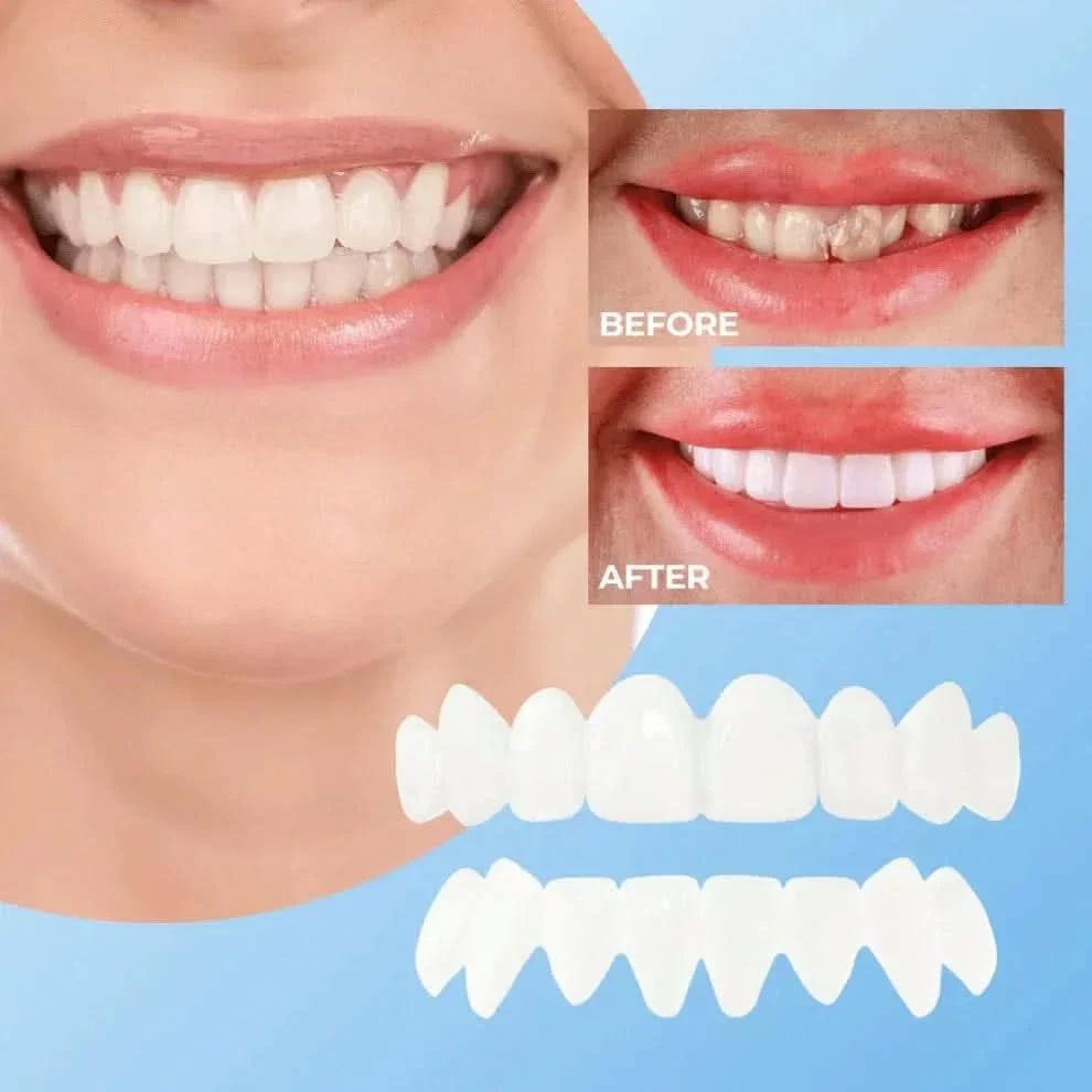 Veenora™ Clip-on Veneers