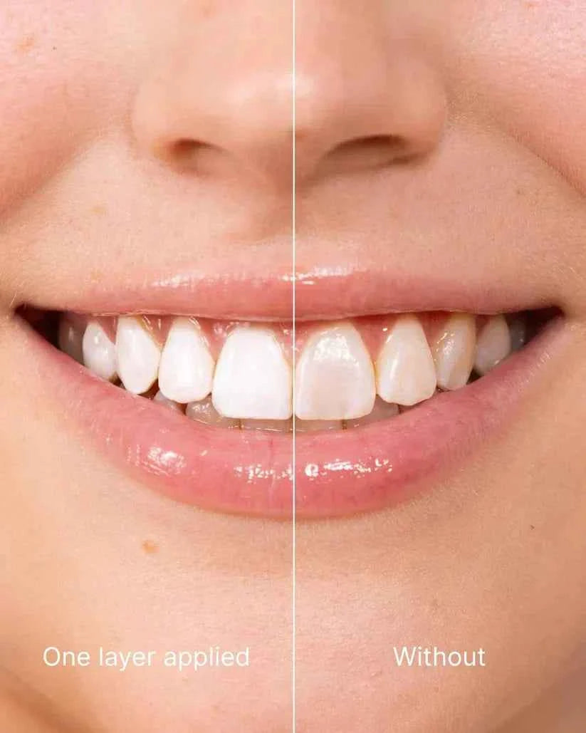 Tooth Polish - Instant Clean Smile