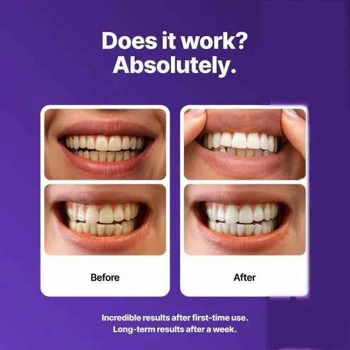 ✨ Nexisify Purple Teeth Whitening Strips (Gen 2)