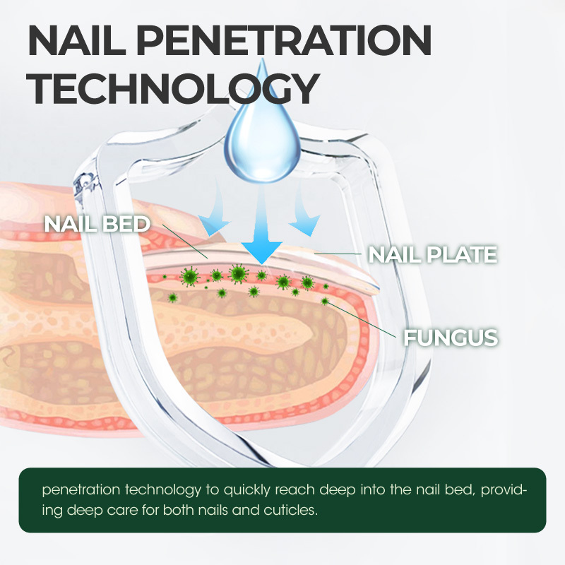 Kreain Nature™Tea Tree & Ginger Nail Treatment