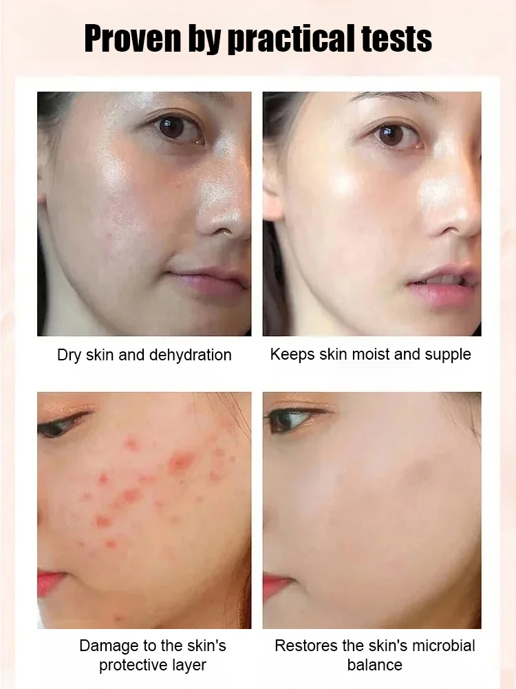 Figs with walnut kernels, two a day to improve intestinal flora, three days to lose 5 kg