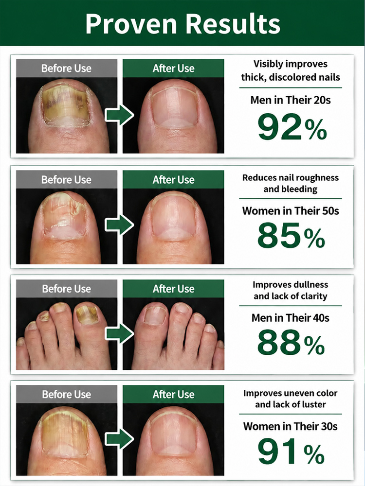 Are you hiding your hands or feet because of yellow, thickened, or brittle nails? 💅Don’t let nail issues keep you from wearing your favorite sandals or showing off your hands. Discover the viral Professional Nail Treatment & Repair Essence — Designed to 