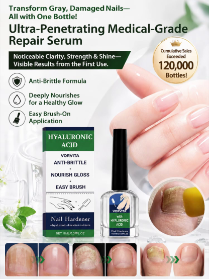 Are you hiding your hands or feet because of yellow, thickened, or brittle nails? 💅Don’t let nail issues keep you from wearing your favorite sandals or showing off your hands. Discover the viral Professional Nail Treatment & Repair Essence — Designed to 