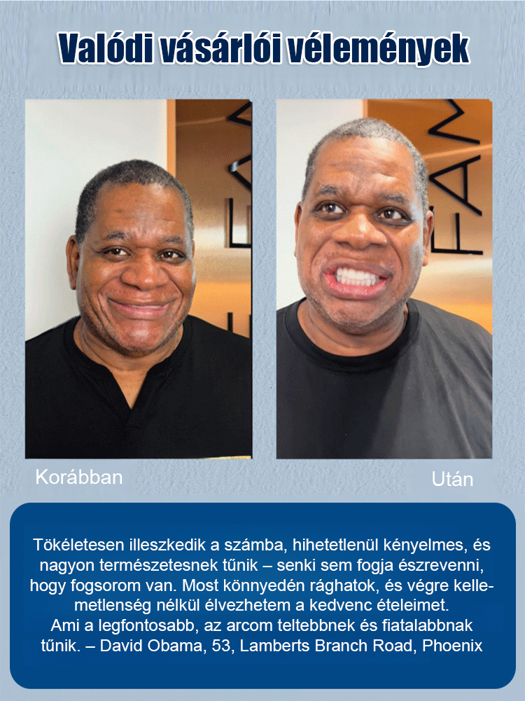 DIYCOS műfogsor díszítés színpadi smink