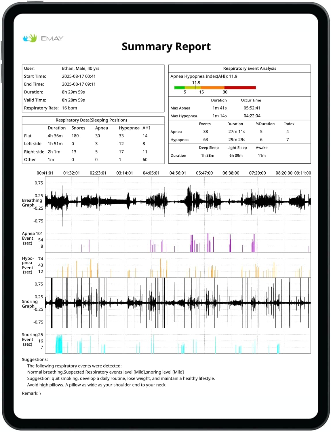 EMAY Sleep Breathing Monitor for Airflow Tracking | Record Breathing Continuously On The App | Monitor Sleep Quality and Respiratory Events | Generate Professional Sleep Report with Data Analysis