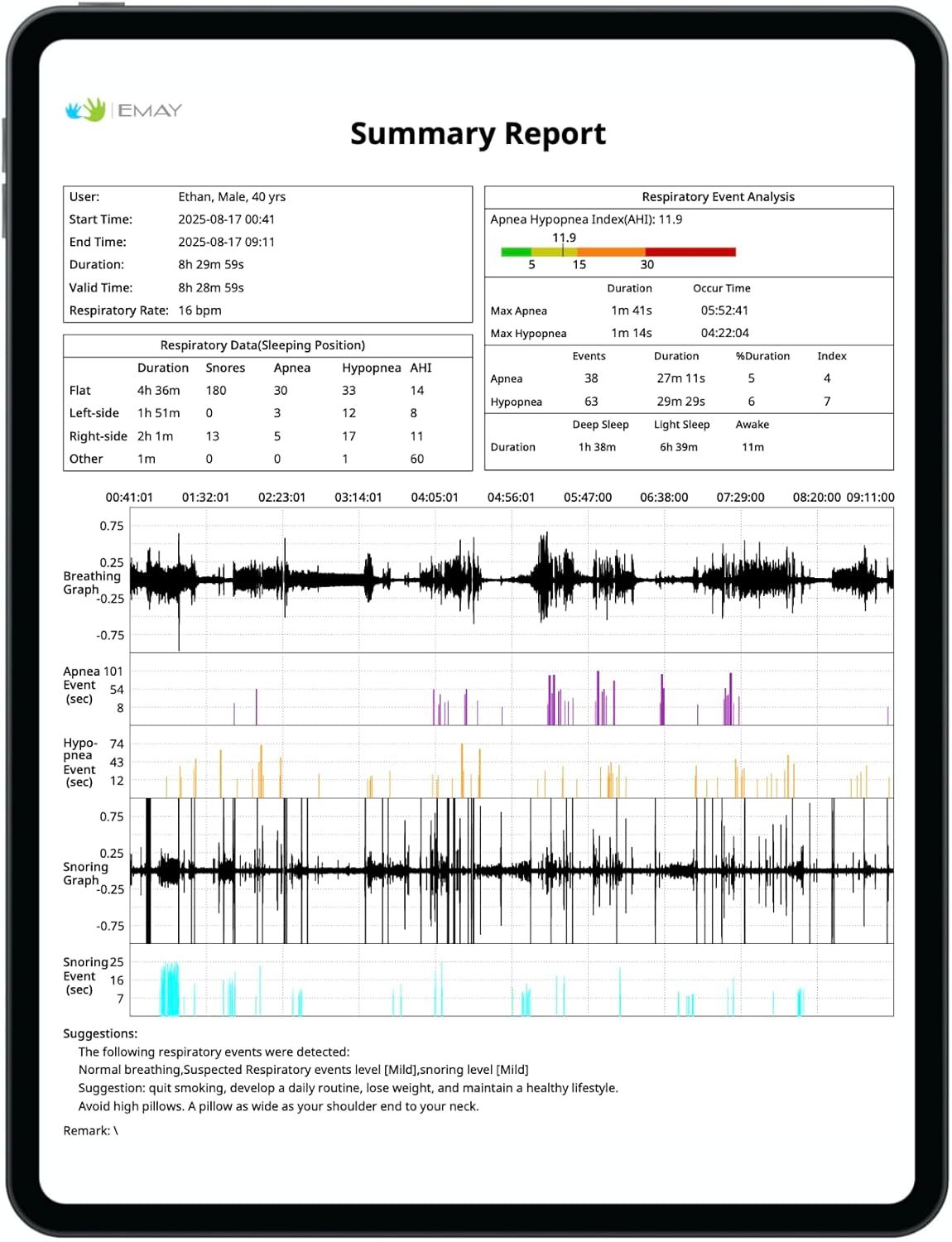EMAY Sleep Breathing Monitor for Airflow Tracking | Record Breathing Continuously On The App | Monitor Sleep Quality and Respiratory Events | Generate Professional Sleep Report with Data Analysis