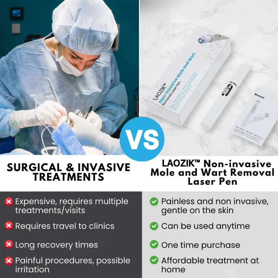 Non-Invasive Mole and Wart Removal Laser Pen