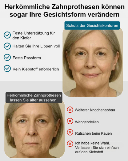 【 Essen + Trinken wie mit echten Zähnen】 Realistische & Anpassbare Zahnblende (Set für Oben + Unten) | Zahnarzt-Empfehlung | 3-Minuten Selbstanpassung | MedizinischerKunststoff 🦷✨